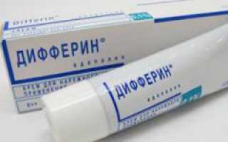 Крем от черных точек «Дифферин»