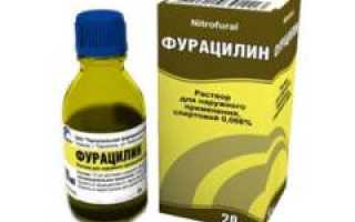 Фурацилин при потливости ног