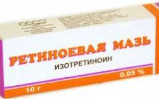 Помогает ли от морщин ретиноевая мазь?