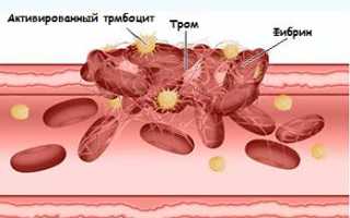 Плохая свертываемость крови у ребенка