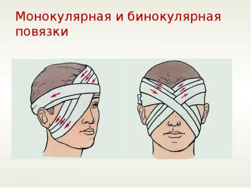 Повязка на глаза