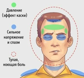 Головная боль напряжения