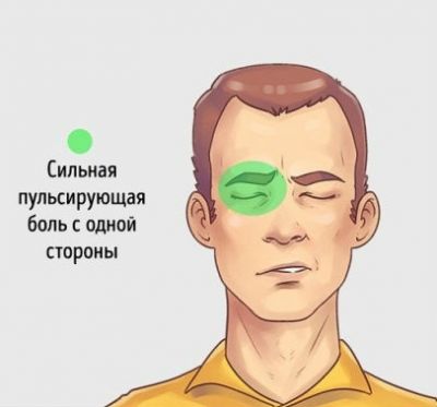 Кластерная боль