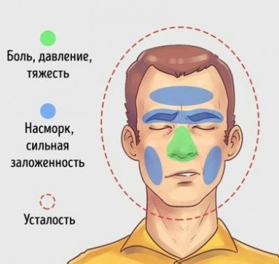 Боль при гайморите