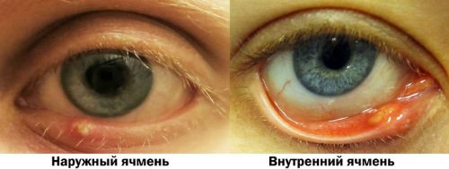 Ячмень