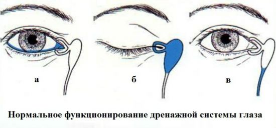 Массаж при дакриоцистите