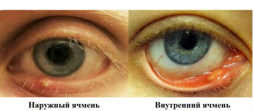 Ячмень
