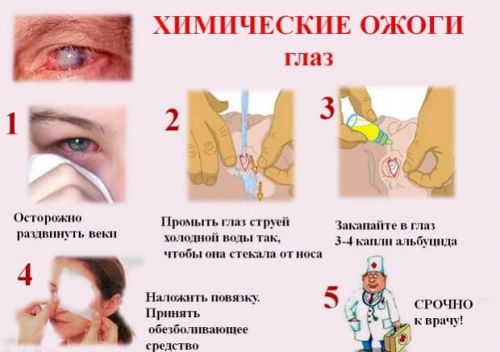 Действия при химическом ожоге
