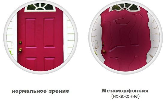 Нормальное и искаженное зрение