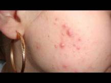 Embedded thumbnail