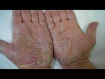 Embedded thumbnail