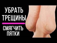 Embedded thumbnail