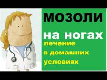 Embedded thumbnail