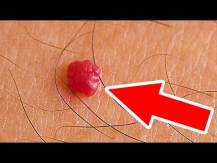 Embedded thumbnail