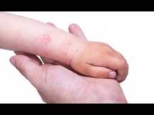 Embedded thumbnail