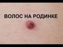 Embedded thumbnail