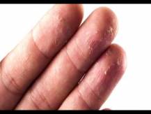 Embedded thumbnail