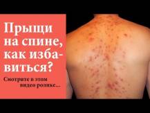 Embedded thumbnail