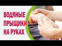 Embedded thumbnail