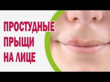 Embedded thumbnail