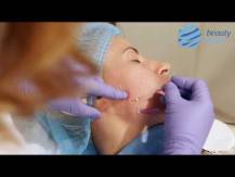 Embedded thumbnail
