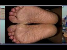 Embedded thumbnail