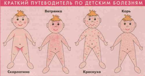 Сыпь при инфекционных заболеваниях