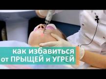Embedded thumbnail