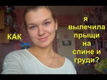 Embedded thumbnail