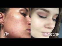 Embedded thumbnail