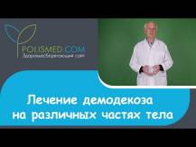 Embedded thumbnail