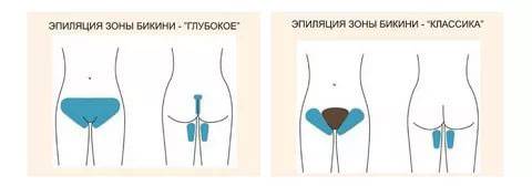 Классическая и глубокая эпиляция