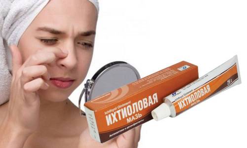 Ихтиоловая мазь