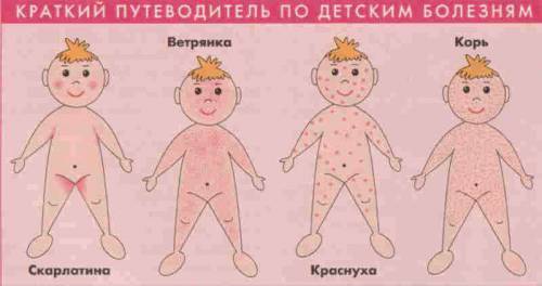 Детские инфекционные болезни