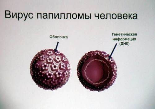 Вирус папилломы человека