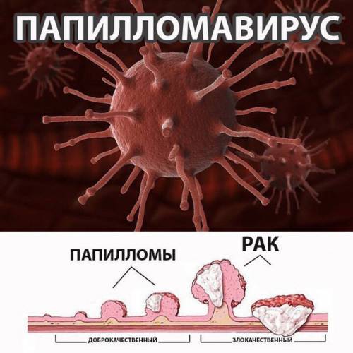 Доброкачественные и злокачественные образования