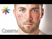 Embedded thumbnail