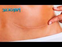 Embedded thumbnail